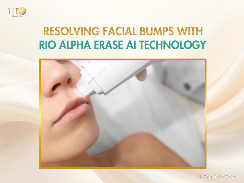 A close-up of Rio Alpha Erase AI technology being applied to a patient's upper lip to resolve facial bumps, including difficult ingrown lip hair, at Rio Beauty Spa.