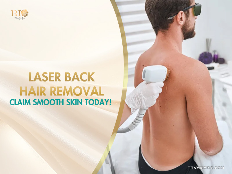 Professional laser back hair removal treatment for a male client at Rio Beauty Clinic to achieve smooth skin.