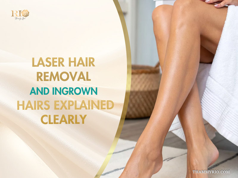 A woman showing smooth and clear legs after learning about laser hair removal and ingrown hairs treatment