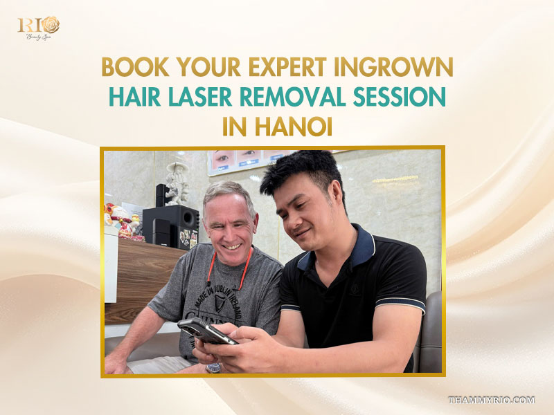 A consultant showing a client options for laser hair removal and ingrown hairs treatment at Rio Beauty Spa Hanoi