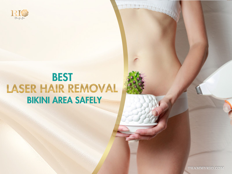 Woman holding a cactus representing unwanted hair during laser hair removal bikini area treatment at Rio Beauty Spa.