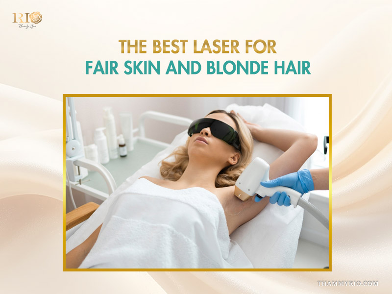 An infographic titled "What to expect laser removal blonde hair results" showing a six-step cross-section diagram of skin layers, hair follicles, and laser treatment progression on light-colored roots.