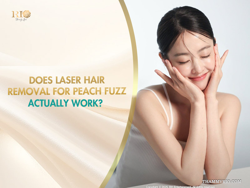 A smiling woman with smooth facial skin holding her cheeks next to laser hair removal for peach fuzz text.
