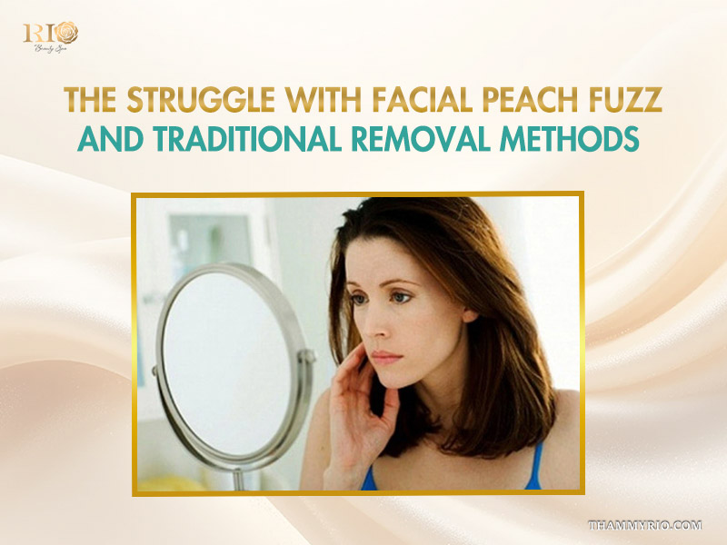 A concerned woman looking at her face in a mirror before choosing laser hair removal for peach fuzz.