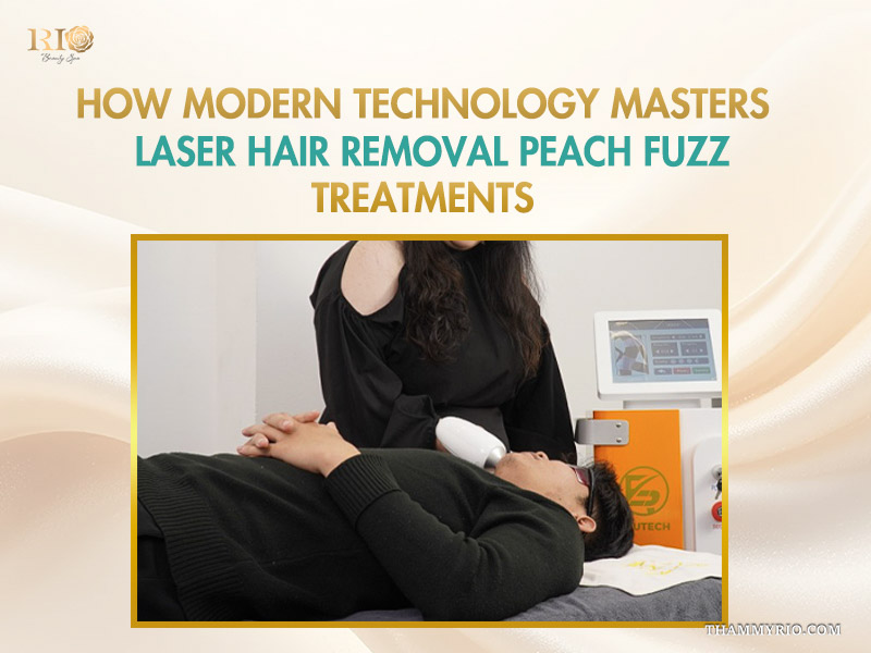 A technician performing laser hair removal for peach fuzz treatment on a male client's face at Rio Beauty Spa.