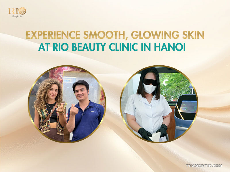 Laser hair removal for peach fuzz service at Rio Beauty Clinic in Hanoi with staff and happy clients.