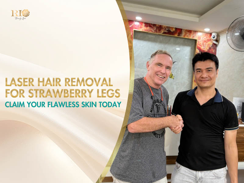 Happy customer choosing laser hair removal for strawberry legs at Rio Beauty Spa.