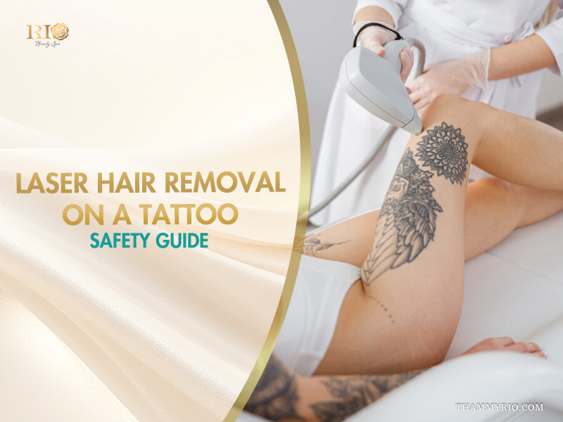 A technician performing laser hair removal on a tattoo area of a woman leg.