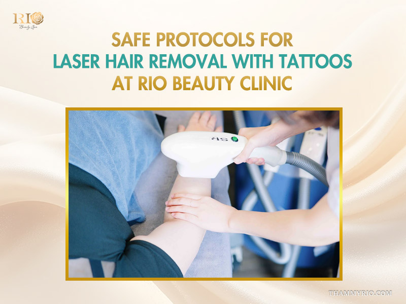 A practitioner applying safe protocols for laser hair removal on a tattoo at a clinic.