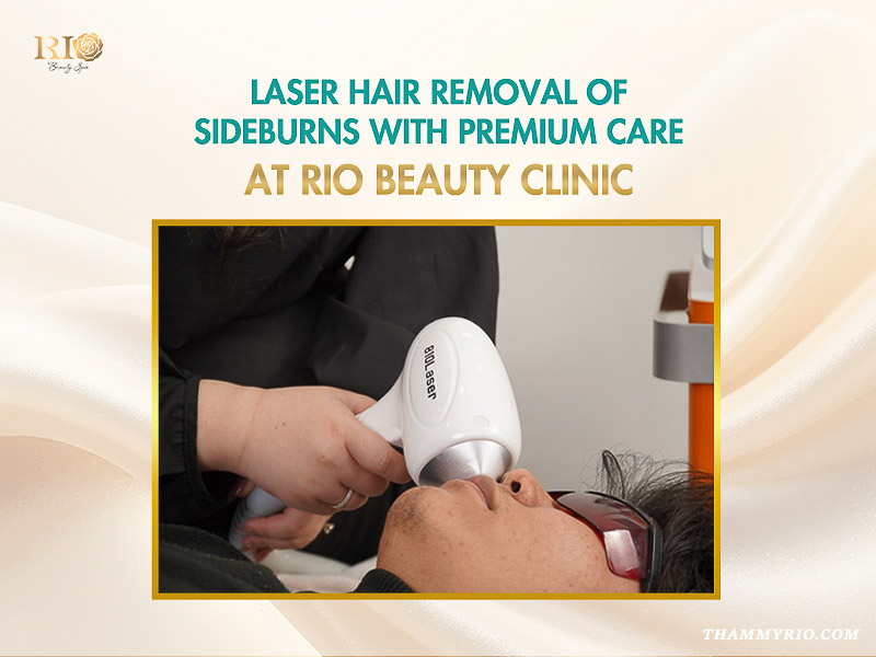 A male client receiving professional laser hair removal sideburns treatment with premium care at Rio Beauty Clinic.