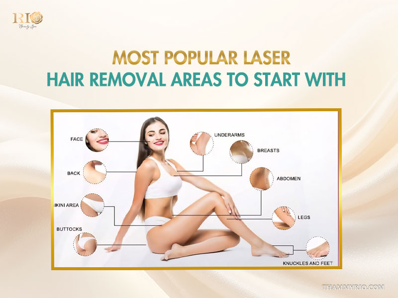 Infographic guide chart mapping the most popular laser hair removal zones to start with at Rio Beauty Clinic for women.