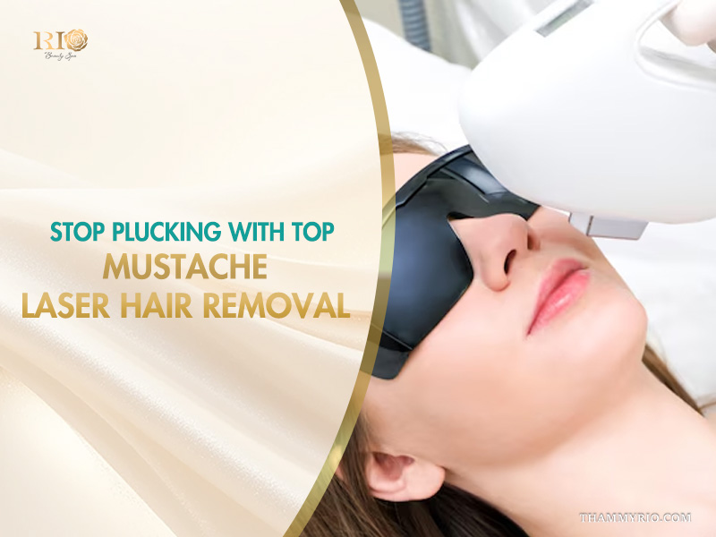 Woman receiving a mustache laser hair removal treatment at Rio Beauty Spa.