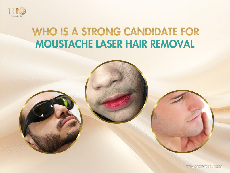 Three examples of ideal candidates for a mustache laser hair removal treatment at Rio Beauty Spa.