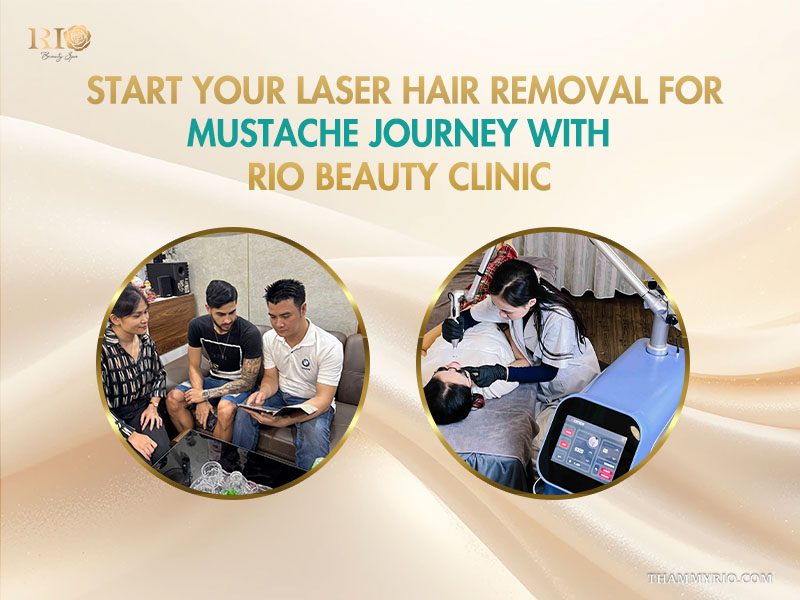 Consultation and mustache laser hair removal treatment session at Rio Beauty Clinic.