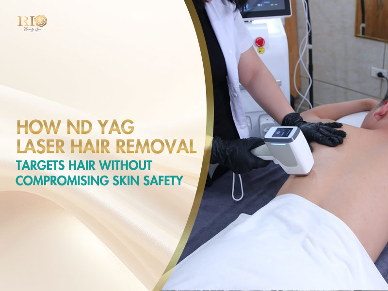 A technician applying nd yag laser hair removal on a relaxing client's arm in a sterile treatment room.