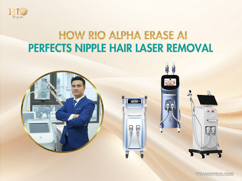 Rio Beauty Spa expert and advanced devices optimizing the nipple laser hair removal process.