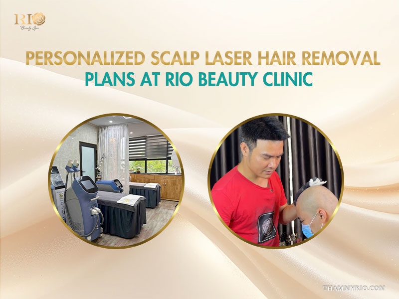Personalized scalp laser hair removal treatment at Rio Beauty Clinic with advanced machinery and professional staff.