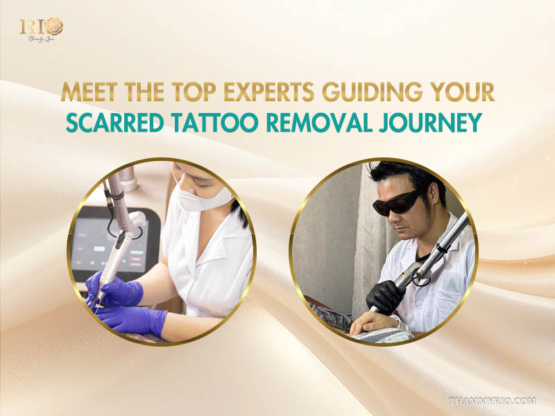 Expert technicians performing professional scarred tattoo removal at Rio Beauty Clinic.