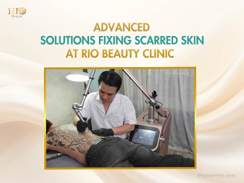 Advanced laser technology for complex scarred tattoo removal at Rio Beauty Clinic.