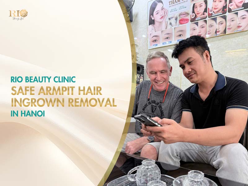 Expert consultation at Rio Beauty Clinic for safe underarm ingrown hair removal in Hanoi