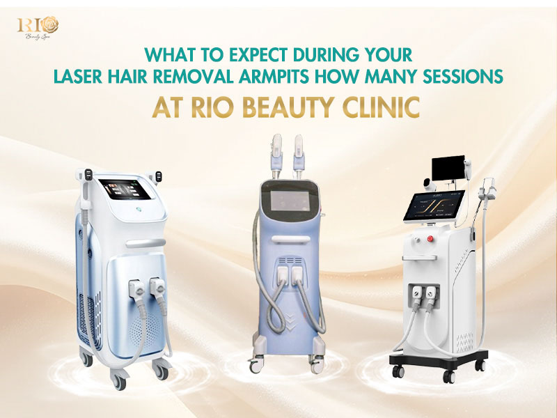 Modern laser machines for underarm laser hair removal how many sessions guide at Rio Beauty Clinic.