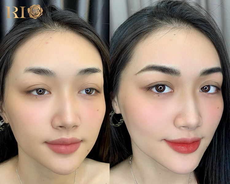 Điêu khắc chân mày giúp cải thiện tình trạng đuôi mày cụt, lệch hoặc không đều, tạo dáng mày cân đối và tự nhiên theo khuôn mặt.