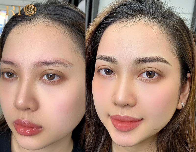 Điêu khắc chân mày sợi cong với kỹ thuật tạo sợi mềm mại, ôm theo đường cong tự nhiên của chân mày giúp gương mặt hài hòa và thanh tú hơn.