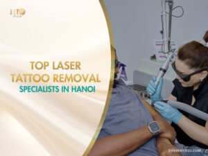Laser tattoo removal specialist performing a treatment on a male client.