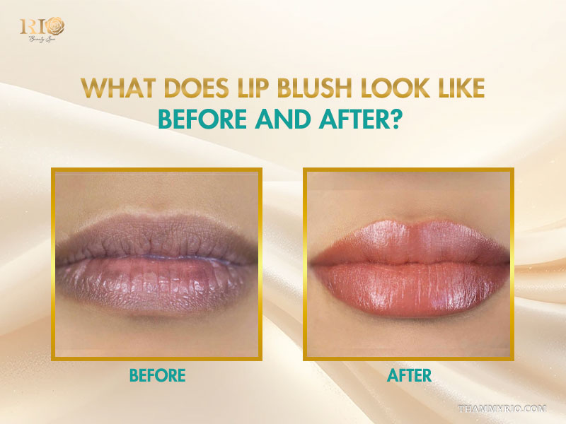 Lip blushing before and after comparison demonstrating color correction at Rio Beauty Clinic.