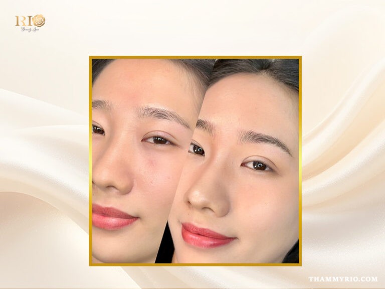 Điêu khắc chân mày Douyin Brows tạo sợi bằng kim Nano siêu vi, kết hợp hiệu ứng Ombre nhẹ giúp chân mày mềm mại, tự nhiên và đầy đặn.