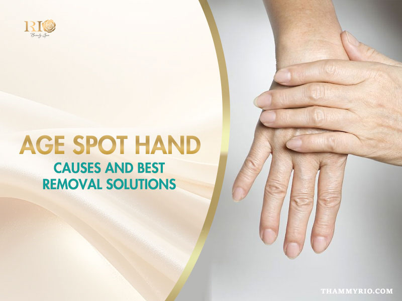 Age spot hand causes and removal solutions banner