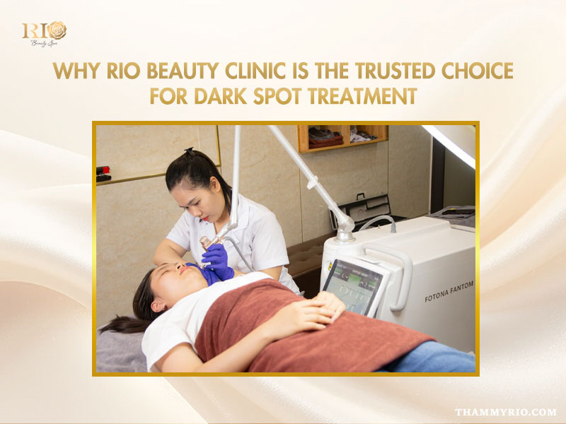 Why Rio Beauty Clinic is trusted for dark spot treatment