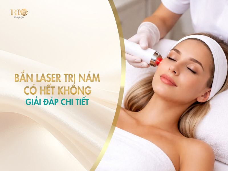 Giải đáp thắc mắc bắn laser trị nám