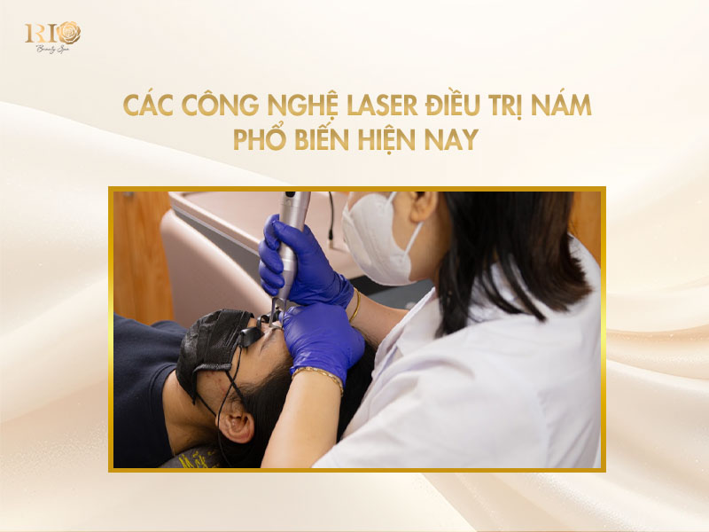 Các công nghệ bắn laser trị nám phổ biến