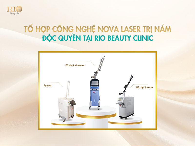 Hệ thống máy bắn laser trị nám tại Rio Beauty Clinic
