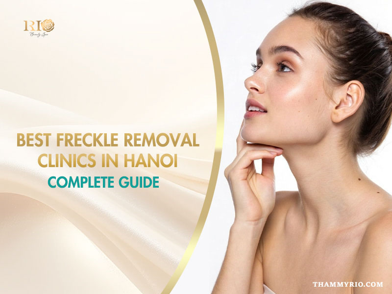 Best freckle removal clinic in Hanoi offering complete treatment guide