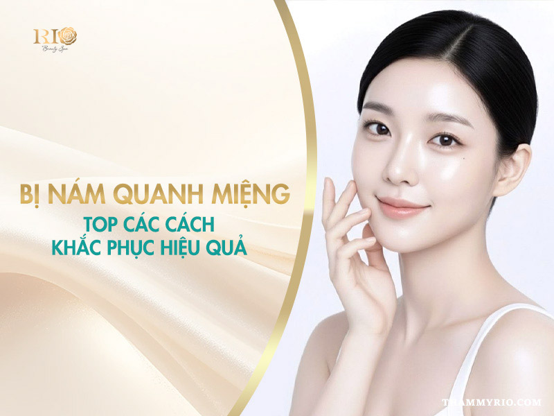 Top các cách khắc phục hiệu quả tình trạng bị nám quanh miệng.
