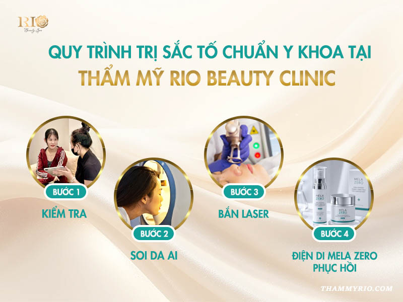 Quy trình 4 bước chuẩn y khoa điều trị sắc tố cho người bị nám quanh miệng tại thẩm mỹ Rio Beauty Clinic.