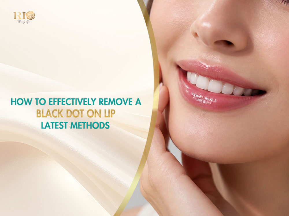 Black spot on lip removal with modern treatment methods at Rio Beauty Clinic