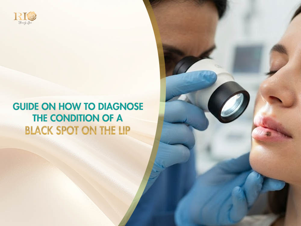 Specialist examining a black spot on lip for proper diagnosis