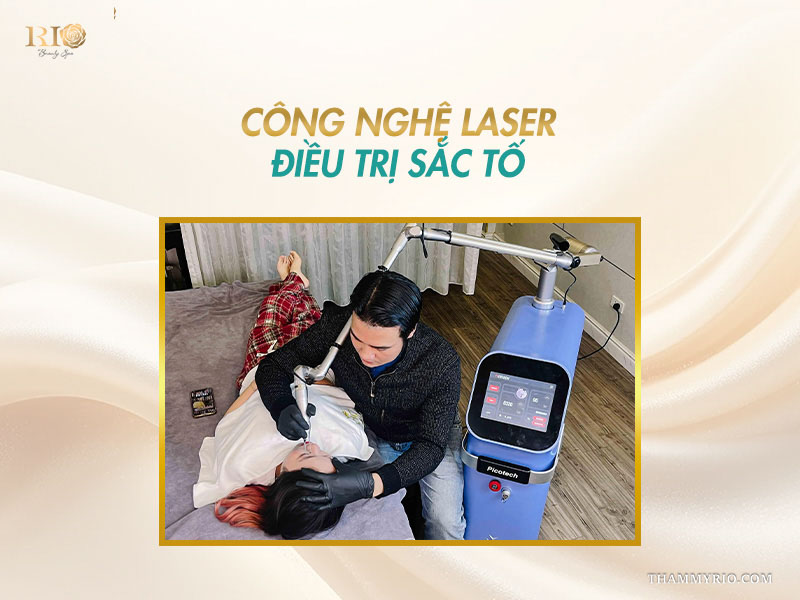 Chuyên gia thẩm mỹ sử dụng máy Picotech laser trục khuỷu công nghệ cao để bẻ gãy đốm sắc tố trên mặt khách hàng