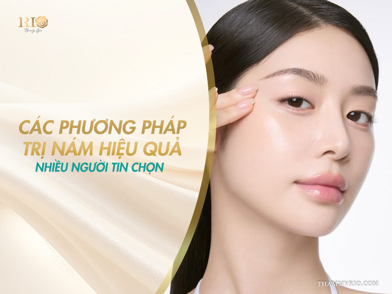 Làn da căng bóng mỏng mịn sau khi thực hiện các phương pháp trị nám hiệu quả tại Rio Beauty Clinic.