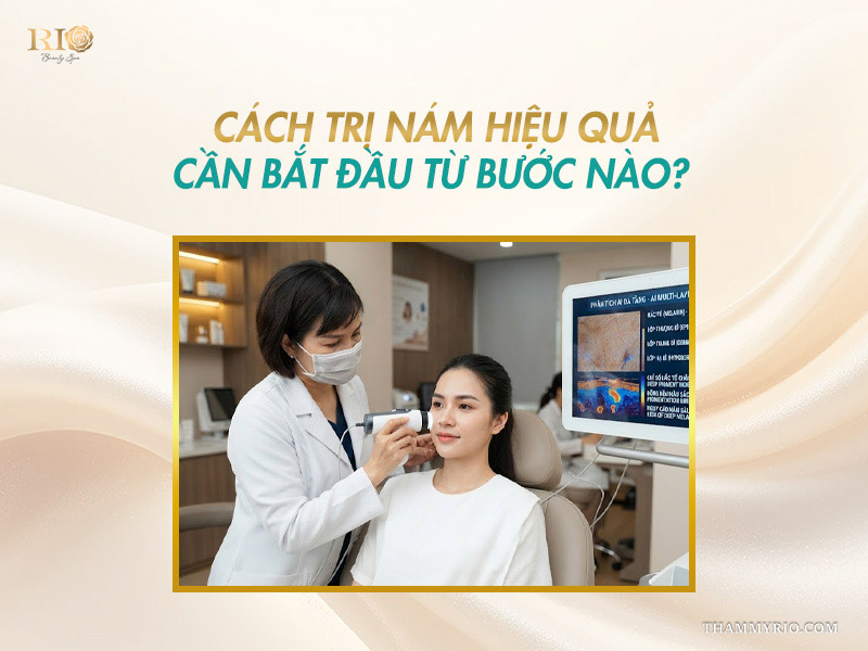 Chuyên gia phân tích da đa tầng bằng công nghệ AI xác định cách trị nám hiệu quả nhất.
