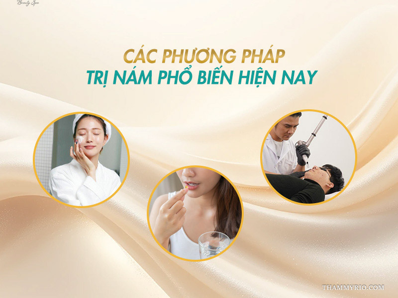 Tổng hợp các phương pháp trị nám phổ biến hiện nay bao gồm kem bôi, viên uống và laser cao cấp.