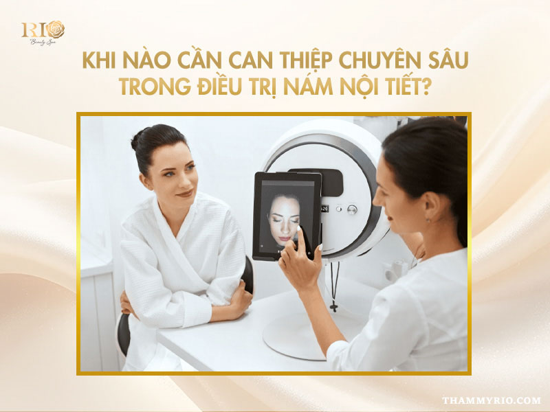 Thăm khám chuyên sâu trong cách điều trị nám nội tiết