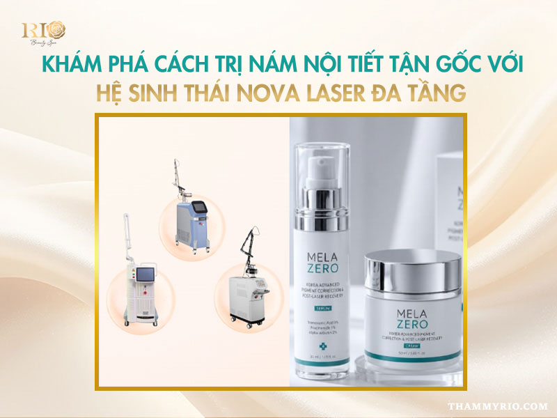 Cách điều trị nám nội tiết bằng hệ sinh thái Nova Laser