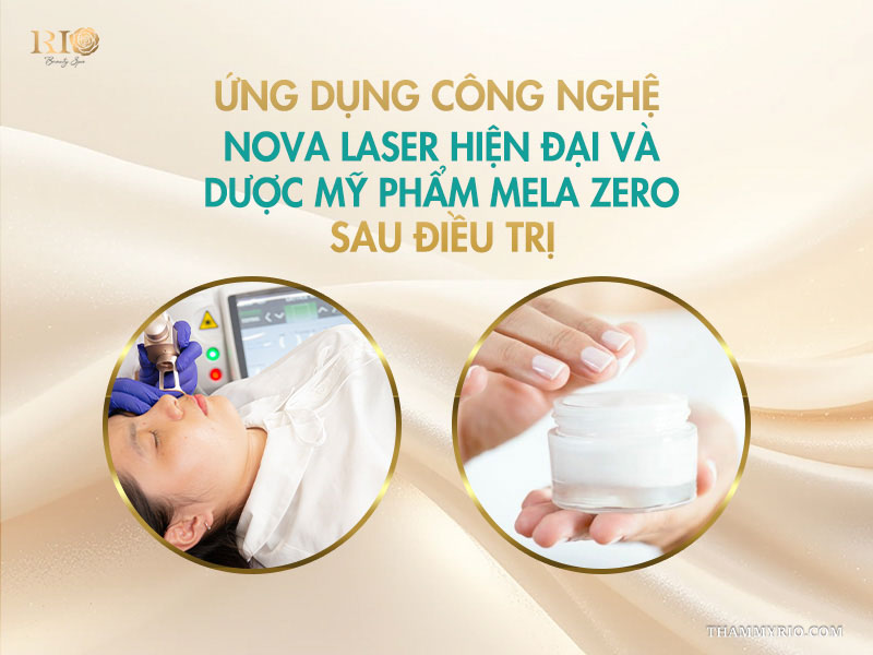 Khách hàng đang chiếu laser trị nám bên cạnh hũ kem phục hồi Mela Zero trên banner phác đồ công nghệ cao. Cách làm nghệ ngâm mật ong trị nám và những điều cần biết