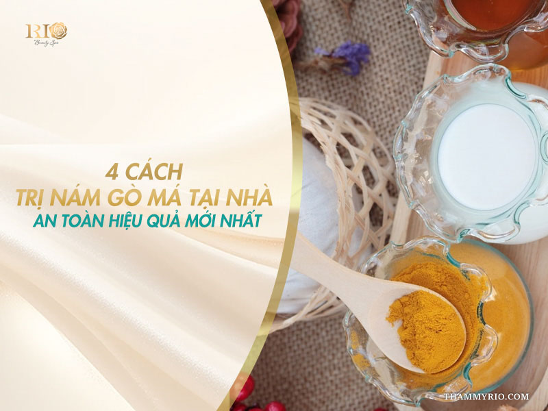 4 cách trị nám gò má tại nhà an toàn và hiệu quả bằng nguyên liệu thiên nhiên.