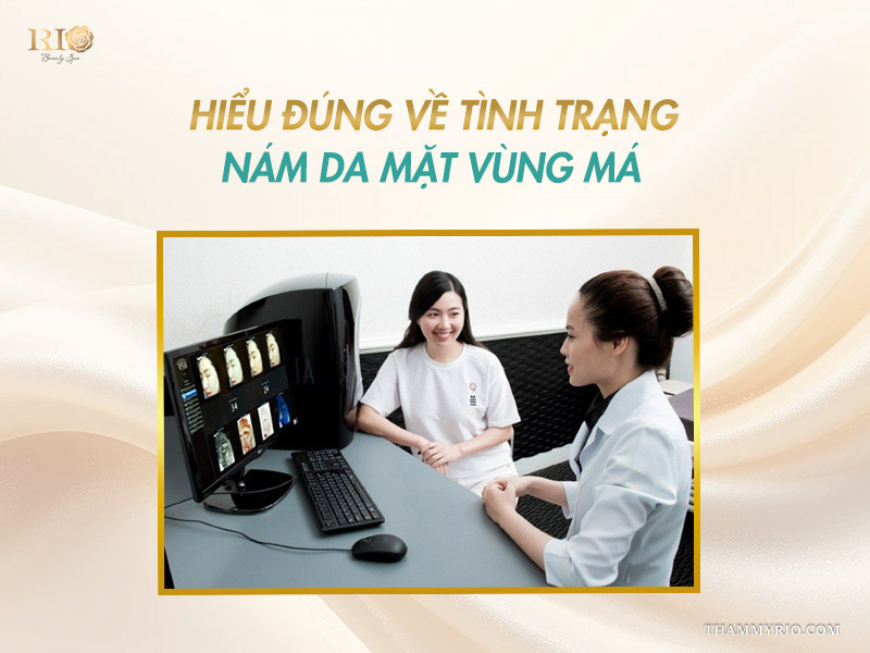 Chuyên gia soi da trước khi tư vấn cách trị nám gò má tại nhà.