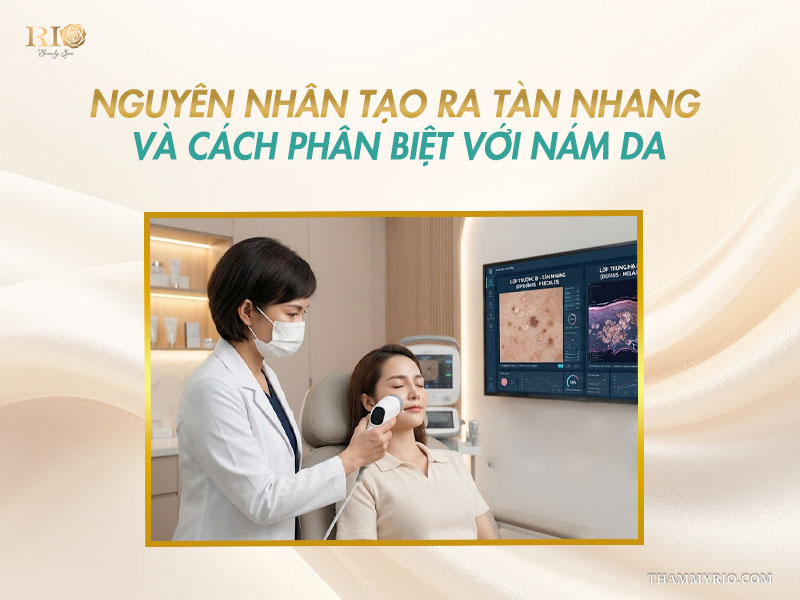 Soi da bác sĩ phân biệt tàn nhang thượng bì và nám da trung bì